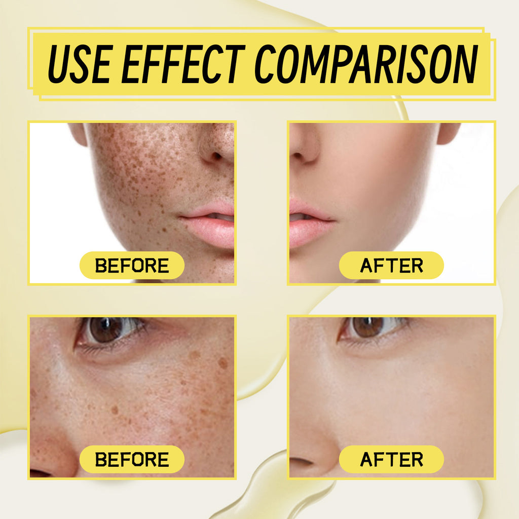 Dark Spot Correcting Serum — Fade, Brighten & Even Skin Tone