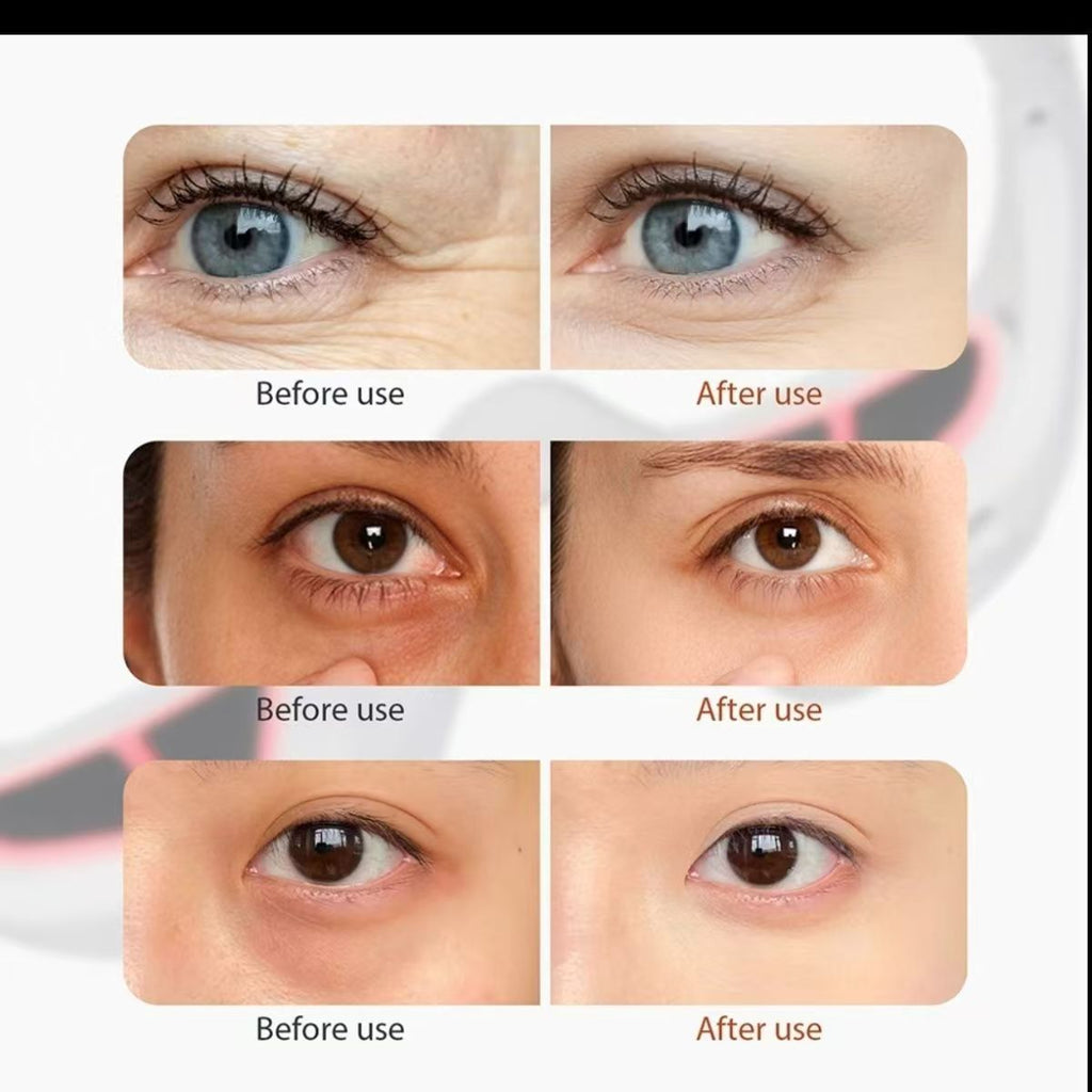 EMS Microcurrent Eye Massager — Depuff, Brighten Dark Circles & Boost Eye Serum Absorption