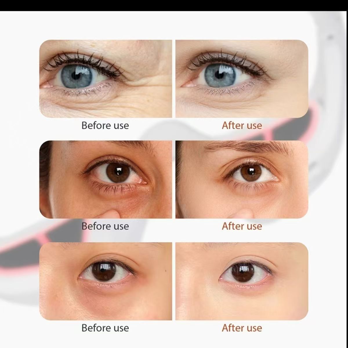 EMS Microcurrent Eye Massager — Depuff, Brighten Dark Circles & Boost Eye Serum Absorption