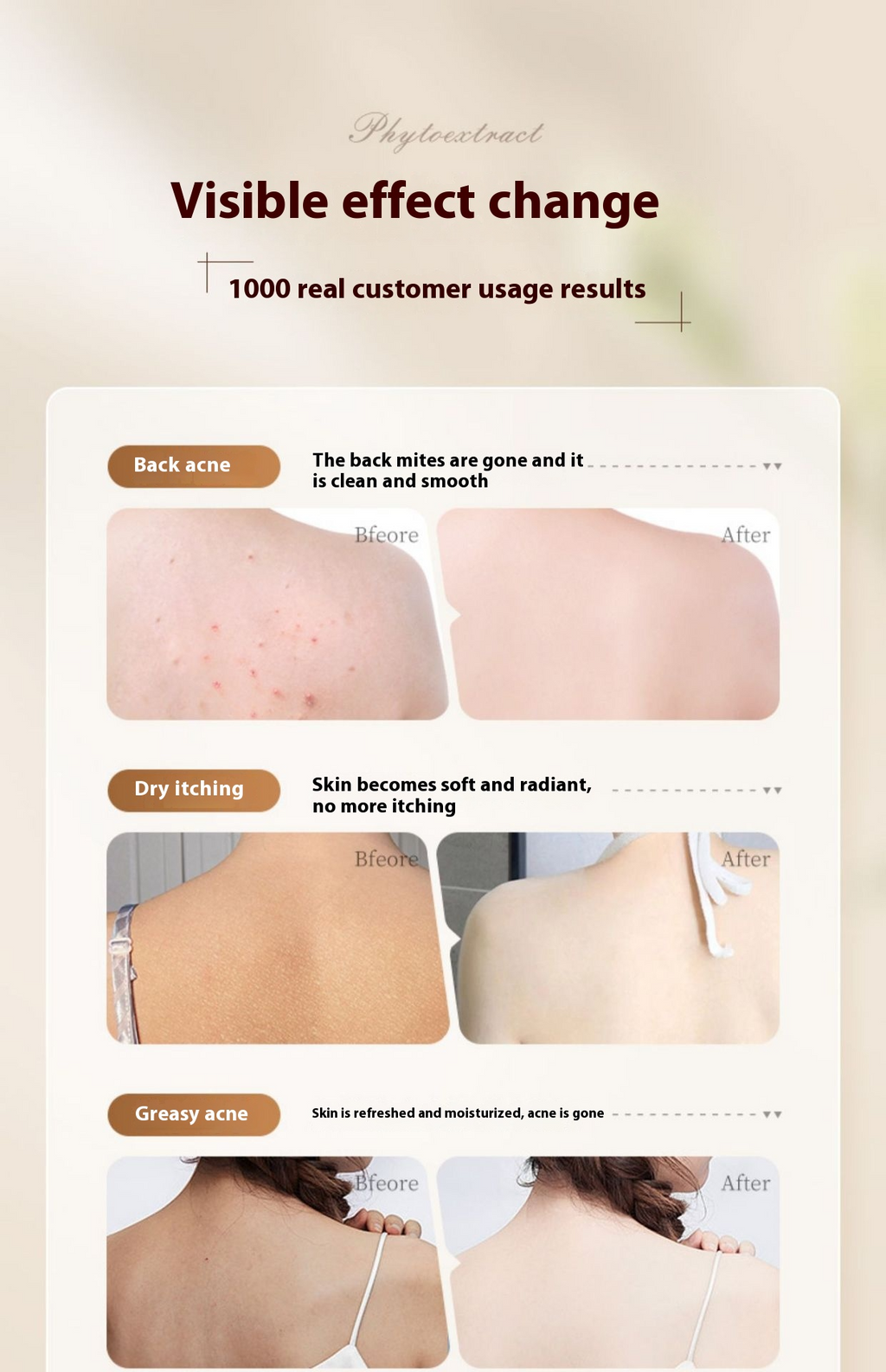 Anti-Acne Body Shower Gel – Clarifying Body Wash for Bacne, Chest Acne & Blemish-Prone Skin