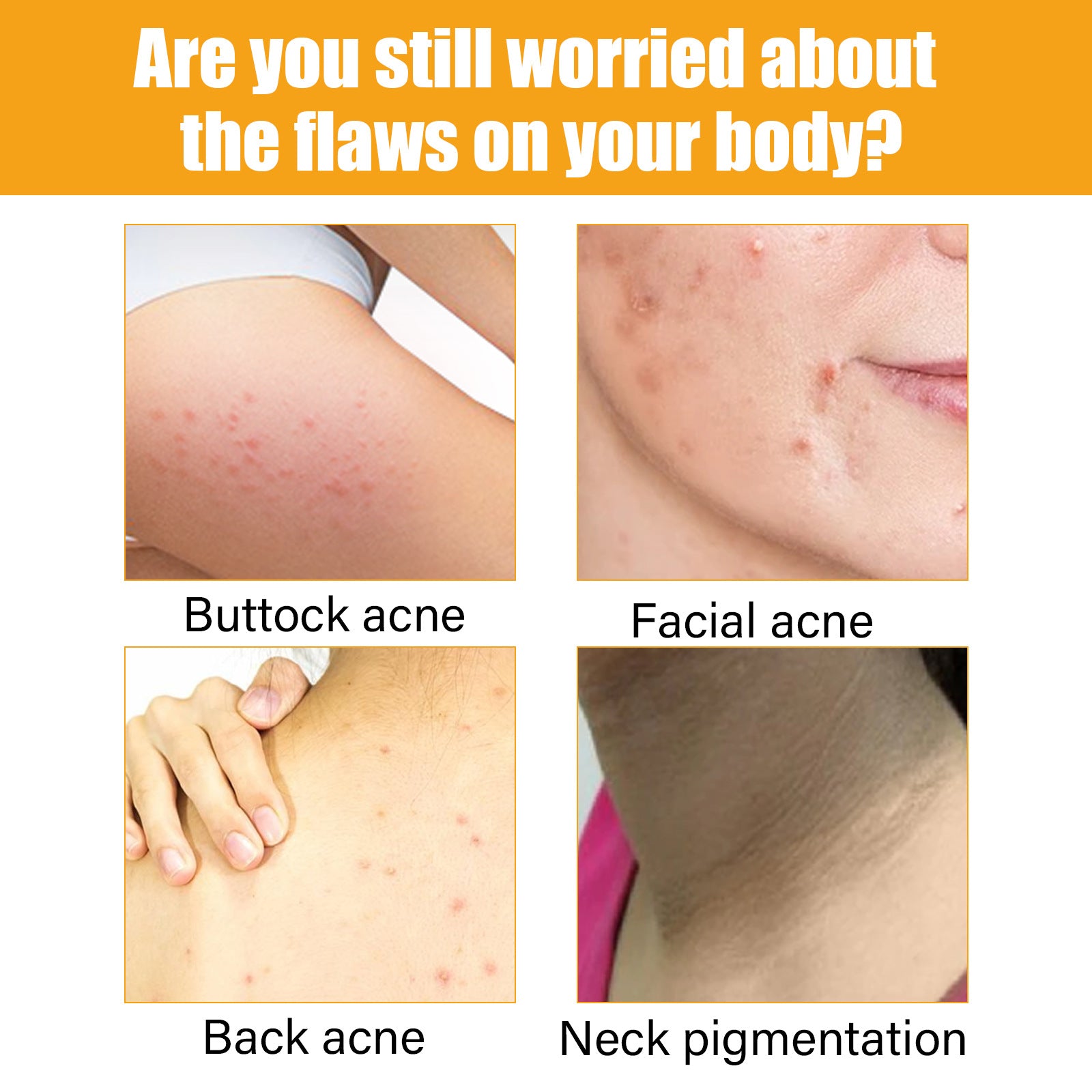 Acne Treatment Essence