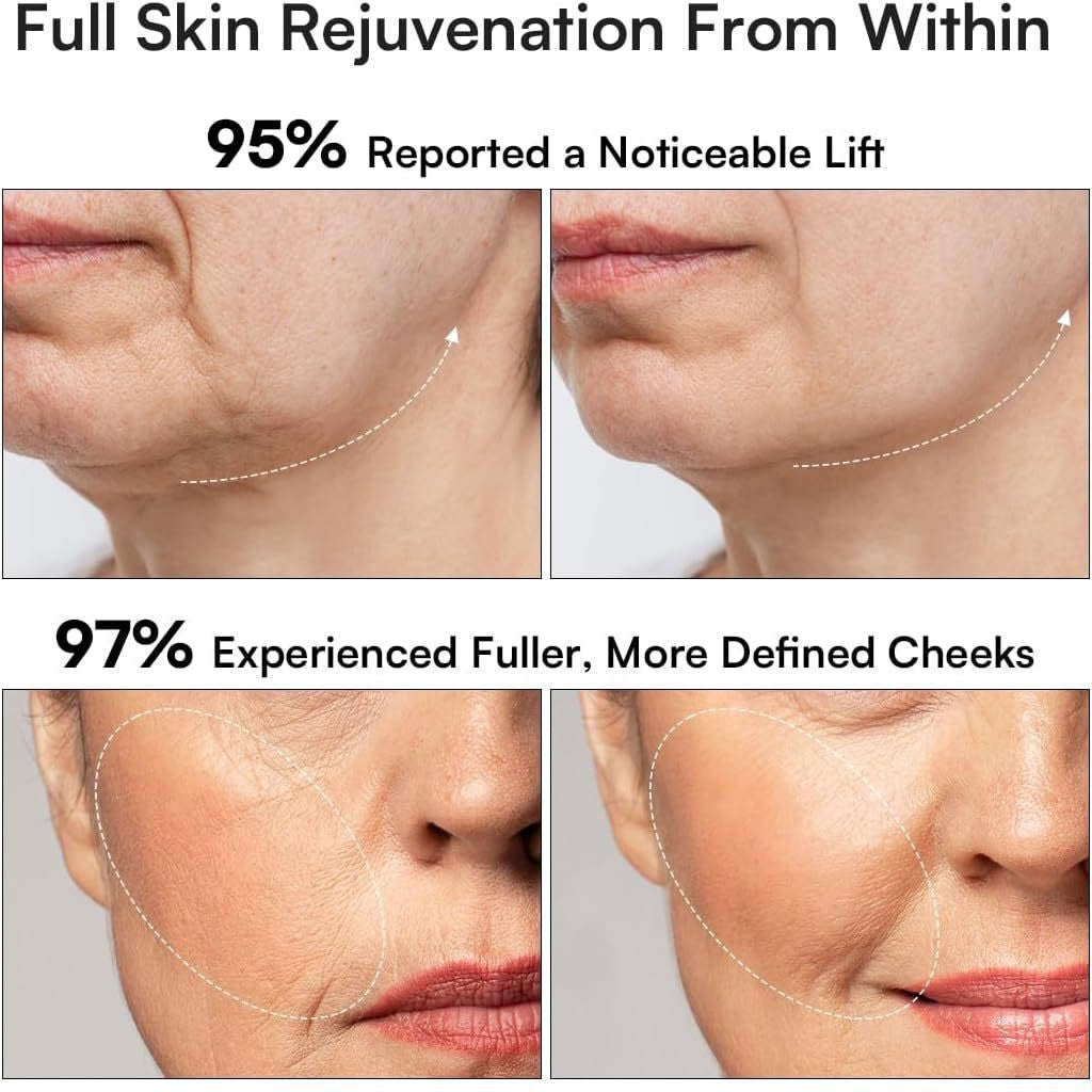 Microcurrent Face Lift Device with Red Light Therapy — Sculpt, Firm & Glow at Home